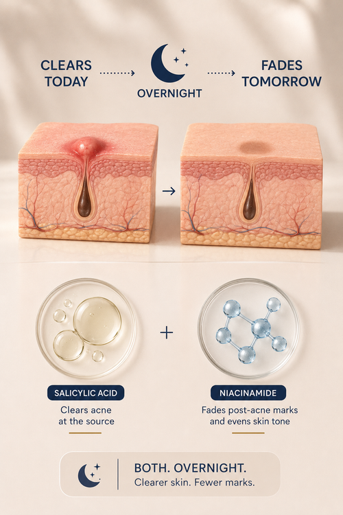 Getting Rid of the Pimple Is Only Half the Job.