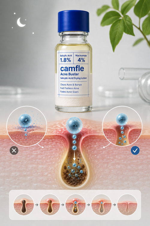 Most Spot Treatments Never Actually Get There.
